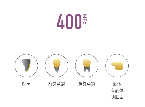 全瓷美学 久经验证
强度400Mpa